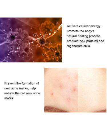 Professional Blue Light Therapy Pencil for Face Stain Removal - Scar, Acne, Wrinkle Treatment - Buy Online on GoSupps.com