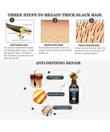 RestoreX Men's Hair Growth Serum S rum De Croissance De Cheveux Anti Chute Cheveux S rum De Cheveux Traitement Pour la Repousse Cheveux huile de pousse des cheveux croissance rapide des cheveux (1pc) - Buy Online on GoSupps.com