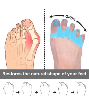 INBOLM Soft Gel Toe Spacers - 8 Pcs | Toe Separators for Overlapping & Curled Toes | Bunion Relief Protectors for Women & Men | Blue - Buy Online on GoSupps.com