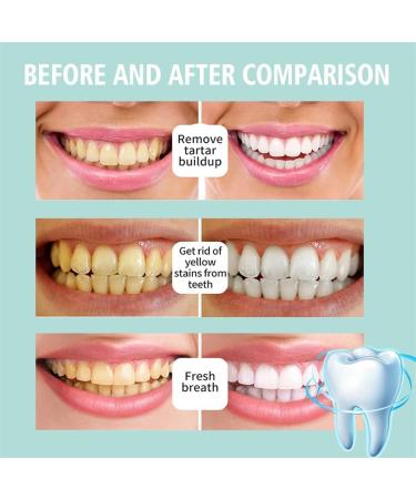 Teeth Care Mouthwash Set - Whitening Foam & Refreshing Breath - Deep Cleaning (2PCs) - Buy Online on GoSupps.com