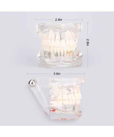 Teeth Model for Dental Teaching & Research | Realistic Adult Teeth Demonstration | No Brand - Buy Online on GoSupps.com