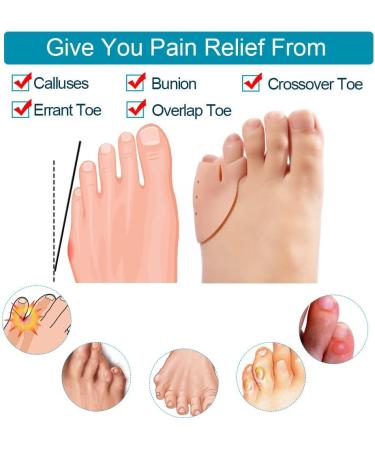Norhogo Silicone Toe Separator - 4 Pairs for Pinky & Overlapping Toes Relief | Comfortable Toe Spreader for Pain & Pressure Relief - Buy Online on GoSupps.com