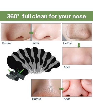 Blackhead Nose Strips Nose Strips Anti Nosestripes Blackheads 20 Pieces Pore Strips Pore Cleaning with Activated Carbon Remove Blackheads and Impurities with Blackhead Remover Comedone - Buy Online on GoSupps.com