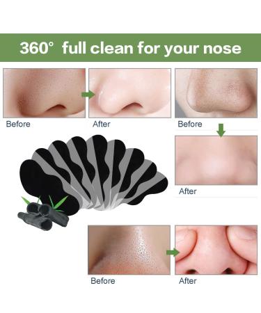 Nosestripes Blackhead Clearing Strips - 25 Pieces for Men & Women | Pore Strip Solution for Clear Skin - Buy Online on GoSupps.com