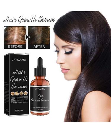 Alopecia Hair Growth Oil for Women & Men | Natural Hair Loss Treatment Serum | Fast-Acting Vegan Scalp Fertilizer - Buy Online on GoSupps.com