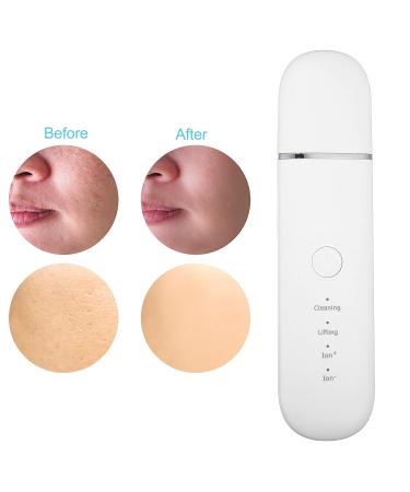VOCOSTE Facial Scrubber Spatula Blackhead Remover - Skin Scraper Tool for Deep Cleansing | Water Mist Technology | White Gold - Buy Online on GoSupps.com