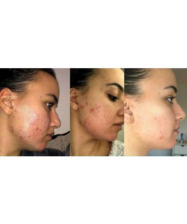 Retinol Gel 0.05 Vitamin A Repairs Fine Lines & Wrinkles Scar Treatment Age and Sun Spots Anti-Aging Formula 20 Grams (0.05) - Buy Online on GoSupps.com