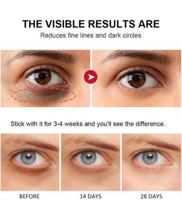 Retinol Eye Stick Retinol Eye Cream Eye Balm Stick Eye Cream for Puffiness Retinol Eye Cream for Dark Circles Eye Brightener Stick for Dark Circles Smoothens Wrinkle Eye Cream - Buy Online on GoSupps.com