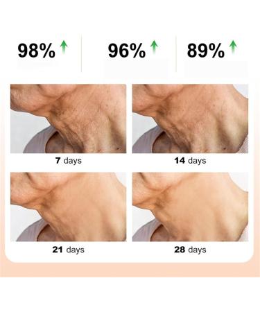 Double Retinol Anti-Wrinkle Neck Cream for Women Fine Line Lifting Neck Cream with Retinol Neck Lifting Cream Neck Firming Cream - Great for Tightening Fine Lines - Buy Online on GoSupps.com