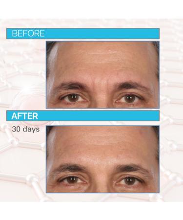 Dr. Mark Pinsky Trace + Erase Wrinkle Filler Treatment with Hyaluronic Acid for Deep Lines Crow s Feet Laugh Lines Plumps Skin Improves Elasticity Serious Skincare 1 oz (2Pack) - Buy Online on GoSupps.com