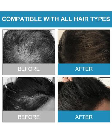 Instant Hair Volume Powder for Men & Women - Invisible Hair Sealing & Concealing Solution - Black - Anti-Hair Loss - Buy Online on GoSupps.com