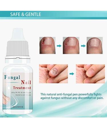 Fungal Nail Treatment - Anti-fungal Nail Solution for Toenails & Fingernails (2PCS) - Buy Online on GoSupps.com