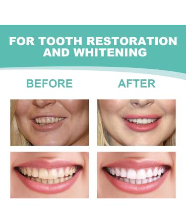 Buy 2 Pairs Snap-On Dentures for Women & Men - Veneers for Missing Teeth | Comfort & Confidence in Every Smile - Buy Online on GoSupps.com