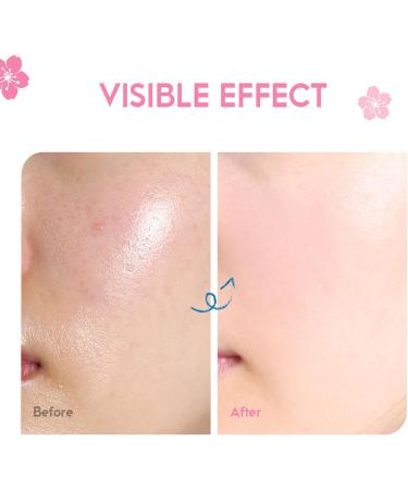 Japan Sakura Face Moisturizer for Women Cherry Blossom Essence Face Cream Moisturiser Face Women with Vitamin C And Sakura Extract Hydrating Moisturizing Skin Care Products Enhance Skin Elasticity - Buy Online on GoSupps.com