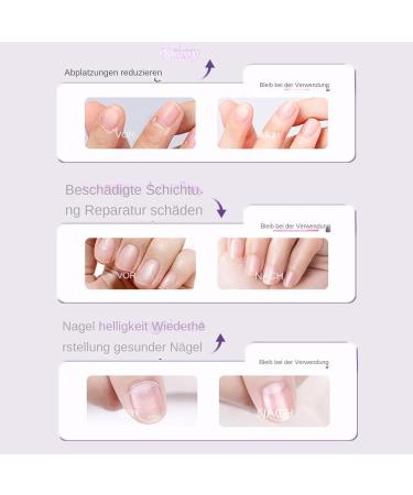 Nail Care Stick nail care stick for brittle dehydrated nails nail oil cuticle oil pen nail care stick cuticle oil pen for repair of cracked and nails 35 ml - Buy Online on GoSupps.com