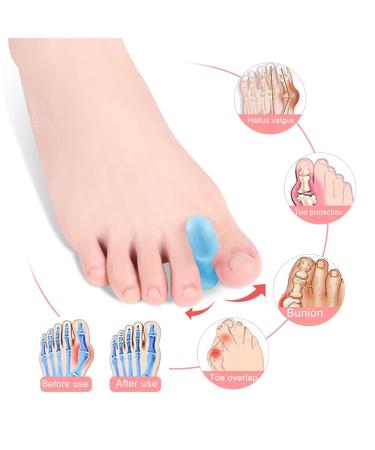 6 Pcs Upgraded Gel Toe Separators Bunion Corrector Orthotics - Blue M - Buy Online on GoSupps.com