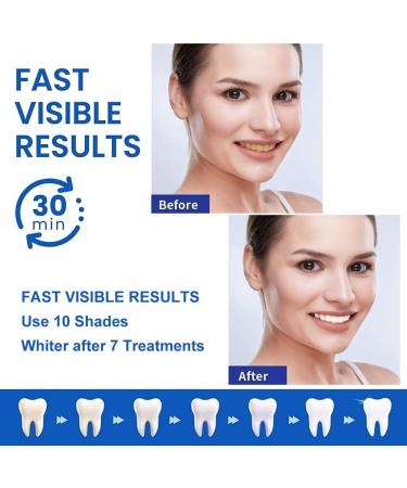 Effective Tooth Whitening Strips - 16 Pieces | White Stripes Teeth Bleaching & Whitening Strips - Buy Online on GoSupps.com