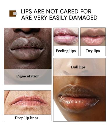 2PCS Lip Lightening for Dark Lips Turmeric Lip Balm for Smokers Lip Brightener for Smokers Dark Lip Lip Scrub for Dark Lips to Lighten Lip Exfoliator Scrub for Lip Softening & Hydration - Buy Online on GoSupps.com