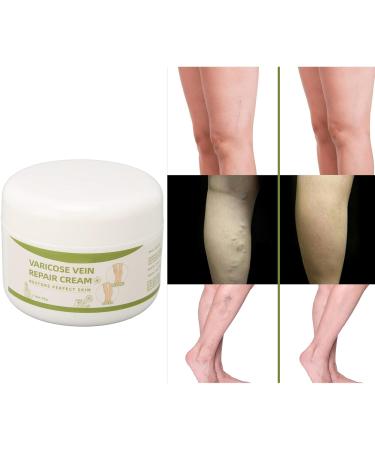 Cream for Varicose Veins for Legs 50G Natural Oils Formula Phlebitis Relief Treatment Soothing Cream for Anti Varicose - Buy Online on GoSupps.com