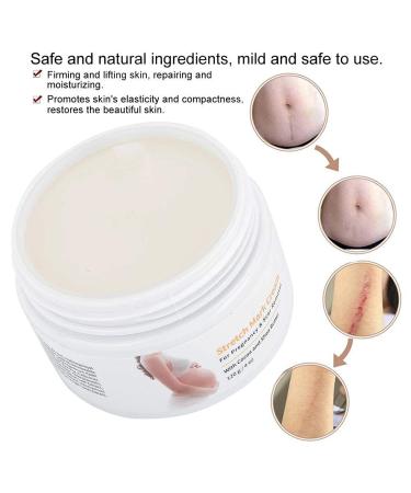 Postpartum Stretch Strip Cream - 120g Stretch Mark Repair for Scars & Belly Skin - Buy Online on GoSupps.com