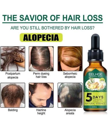 dijiusidy Ginger Hair Growth Oil Prevent Baldness Good-absorption Fast Growing 30MLSerum Nourish Tools Female - Buy Online on GoSupps.com
