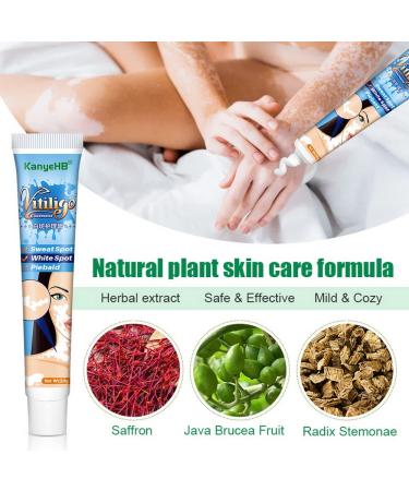 MANAM Vitiligo Cream - Skin Treatment for Vitiligo, Psoriasis, Leukoplakia - Improve Skin Pigmentation - Reduces White Spots - 0.7 Ounce - Buy Online on GoSupps.com