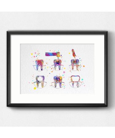 Dienovel Studios Endodontics Therapy Art Print - Watercolor Tooth & Root Canal Decor for Dental Clinics | 8x10 inch DN750 - Buy Online on GoSupps.com