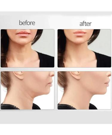 Nadove Micro-Glow Facial Nadove Micro Glow Face Sculptor Micro Glow Facial Machine Microcurrent Multifunctional Facial Massager Double Chin Eliminator (White+White) - Buy Online on GoSupps.com