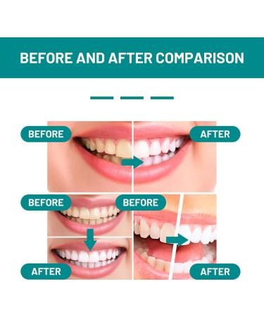 Furzero Smartsmile Oral Mundwasser | Teeth Whitening & Total Care | Prox Smile Shine Tooth Foam - Shop Internationally! - Buy Online on GoSupps.com