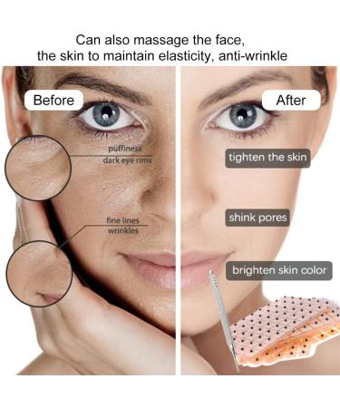 ACUPRESSURE PEN | Acupuncture Massage Tool Meridian Pencil & Scar Treatment | Complete Set with 300 Ear Seeds - Buy Online on GoSupps.com