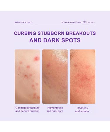 Skin Brightening Cream | 20g Facial Moisturizer | Brightening and Brightening Face Cream - for Women and Men - Even Skin Tone Beauty Care - Buy Online on GoSupps.com