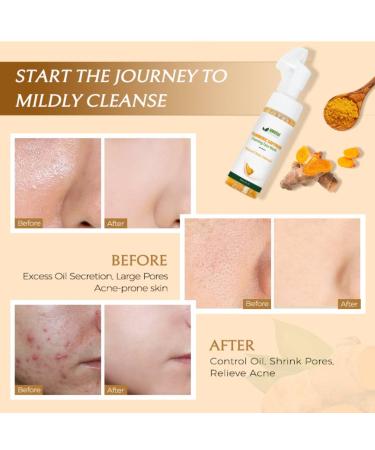 Turmeric Saffron Foaming Face Wash | Gentle Moisturizer for All Skin Types | Natural Ingredients for Nourished Skin - Buy Online on GoSupps.com