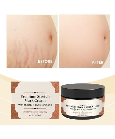Stretch Mark Cream for Pregnancy - 50g Pregnant Belly Cream - Non-Greasy Moisturizer Prevents Stretch Marks and Improves Elasticity - Buy Online on GoSupps.com