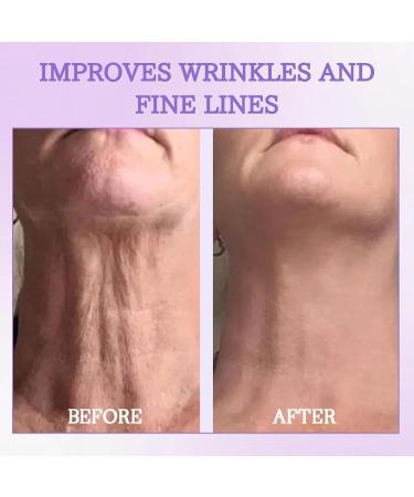 Fubsta LuxeLift Lift & Firm Body Cream Advanced Anti-Wrinkle Firming Cream - So & Firming Moisturizing Moisturizing Cream to Restore Skin Elasticity (3Pcs) - Buy Online on GoSupps.com