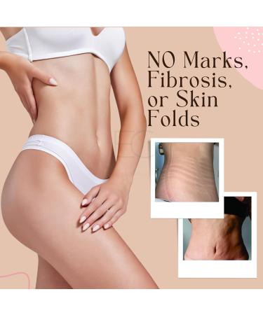 Tummy Tuck Lipo Foam Shapewear Board | Post-Surgery Liposuction Recovery | Abdominal Boards for Women | Tabla Abdominal Post Cirug a - Shop Now - Buy Online on GoSupps.com