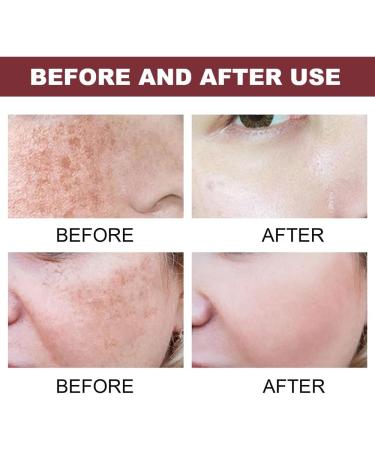 WAWJ Dark Spot Corrector Serum Niacinamide Serum Dark Spot Corrector Serum Brightening Face Serum After Acne - Buy Online on GoSupps.com