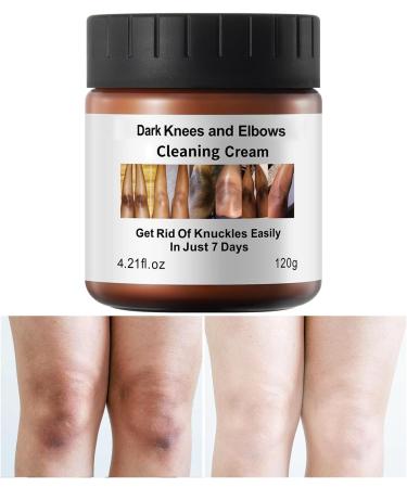 Dark Knees Elbows Knuckles Corrector Cream Skin Cleaning Bleaching Cream for Elbows Knees Armpit Underarm Inner thighs Intimate Areas Dark Spot (120g/4.2oz)