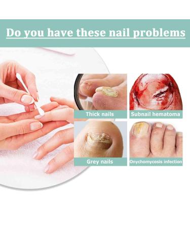 Health Routine Nail Care Pen - Nail Growth & Fungus Treatment - 3PC Set from Abbey Austria - Buy Online on GoSupps.com