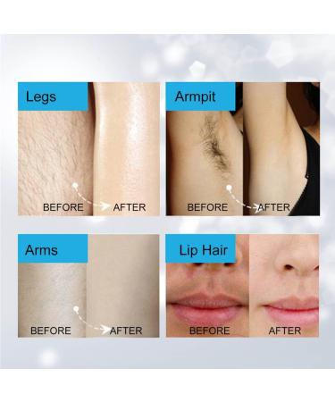 Wallfire 4-in-1 Portable Electric Hair Trimmer for Women Compact Hair Parting Tool Set - Buy Online on GoSupps.com