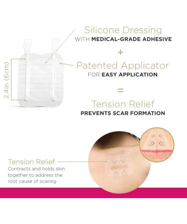 Embrace Active Scar Defense - FDA-Cleared Silicone Scar Sheets for New Scars | 60 Day Supply | Medium 2.4 Inch - Buy Online on GoSupps.com