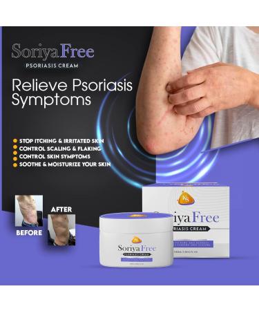 SoriyaFree Psoriasis Moisturizing Cream - 2.0% Salicylic Acid Formula for Eczema Relief, Anti-Itch Properties & Sunburn Soothing - 80g - Buy Online on GoSupps.com