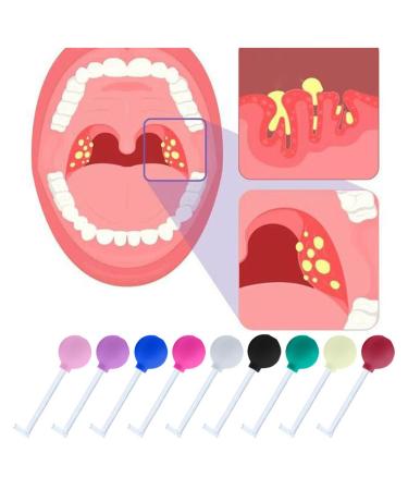 Tonsillenstein remover almond stones made of borosilicate glass for removing tonsil stones remove almond stone tool against bad breath oral care fresh breath (blue)