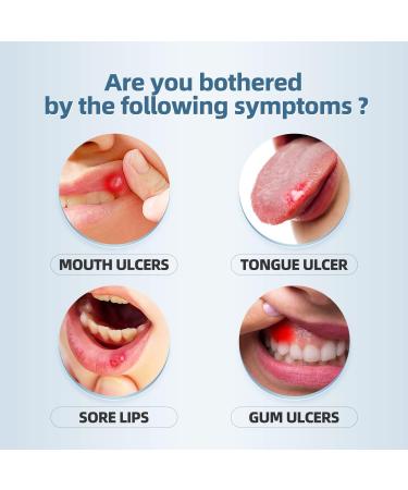 Buy Red Light Therapy Device for Cold Sores & Fever Blisters | Fast Healing & Pain Relief - Buy Online on GoSupps.com