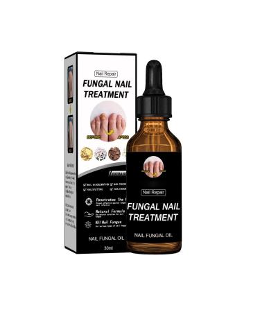Nail Liquid Thickening Shiny Nails Grey Nails Dead Skin Moisturising Nail Nutrition Care Liquid 30ml 50ml CnJ78 (A One Size) 1 count (Pack of 1) a