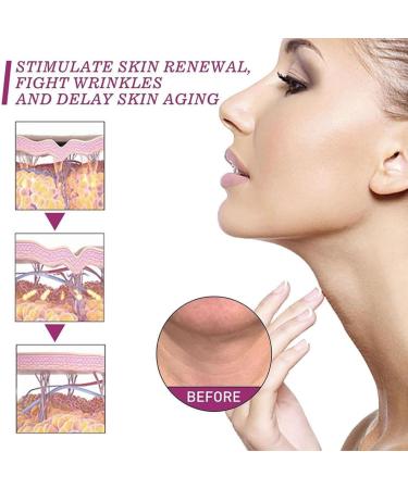 Neckpon Hydrolyzed Collagen Neck Cream Neck Firming Cream Sagging Skin Repair Collagen Neck Firming Cream - Buy Online on GoSupps.com