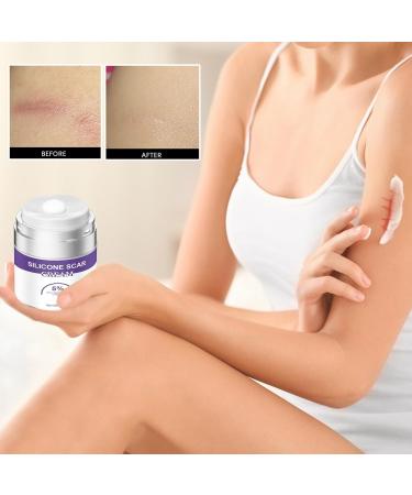  Mimoqk Scar Cream Mark Eraser Skin Recovery 50g Potent Formula Fast Absorption Soothing Blend with Botanicals for Blemishes Burns Cuts C-Section Wounds Leg Face Body - Buy Online on GoSupps.com