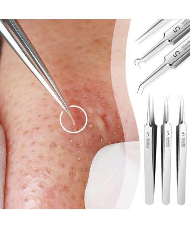 Blackhead Remover Tweezers Ultra-fine No.5 Acne Blackhead Removal Tweezers Acne Pimple Blemish Extractor Curved Needle Clip Tool Face Skin Care Tool Beak Clip - Buy Online on GoSupps.com