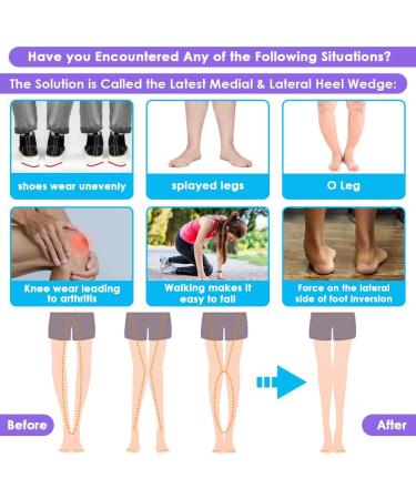3 Layers Adjustable Insoles for Supination & Overpronation - Anti-Slip Heel Wedge for Foot Alignment & Knee Pain Relief (Beige Size S: W 4-7.5/M 6-7 - Buy Online on GoSupps.com