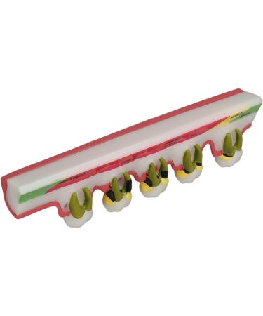 Dental Parodontitis Model - Visualize Stages & Improve Communication Between Dentists and Patients | International Shipping - Buy Online on GoSupps.com