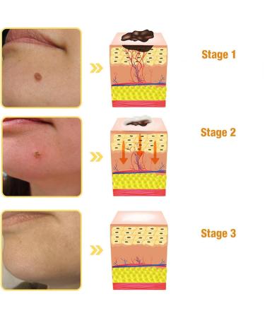 Bee Venom Cream Professional Bee Venom Cream Bee Venom Repair Cream for All Parts of The Body (2 Pack) - Buy Online on GoSupps.com